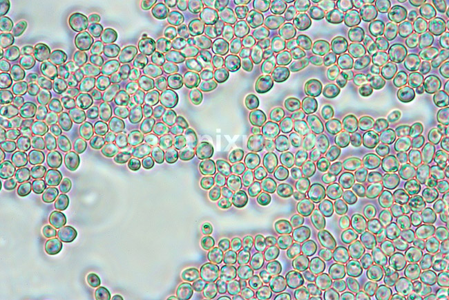 Sukkersvamp. Celler af g�r set i mikroskop; Saccharomyces cerevisiae ; ; ; ; svampe; G�rsvampe, Endomycetales, bageg�r, h�vemiddel