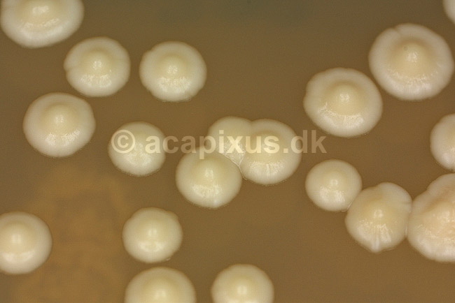 Bageg�r p� agarplade, sukkersvamp; Saccharomyces cerevisiae; ; ; ; svampe; 